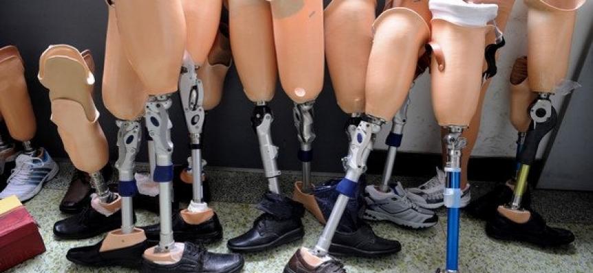 Ortez Protez Uygulama Merkezleri Hakkında Yeni Yönetmelik Yayınlandı 